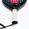 Rachetă de padel Babolat Contact negru/albastru 150115 4