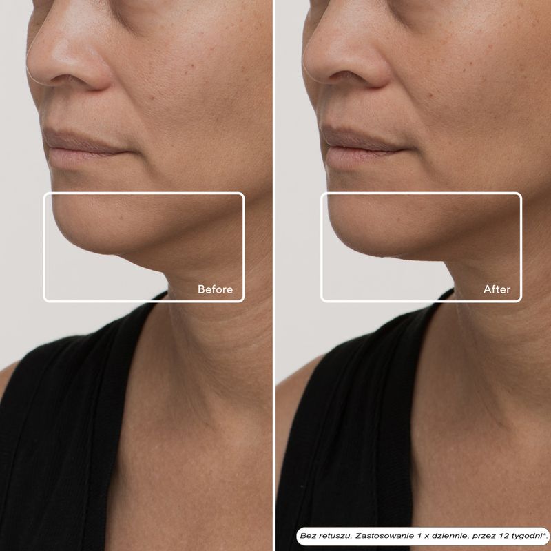 Mască de față LED Therabody TheraFace LED Mask 9