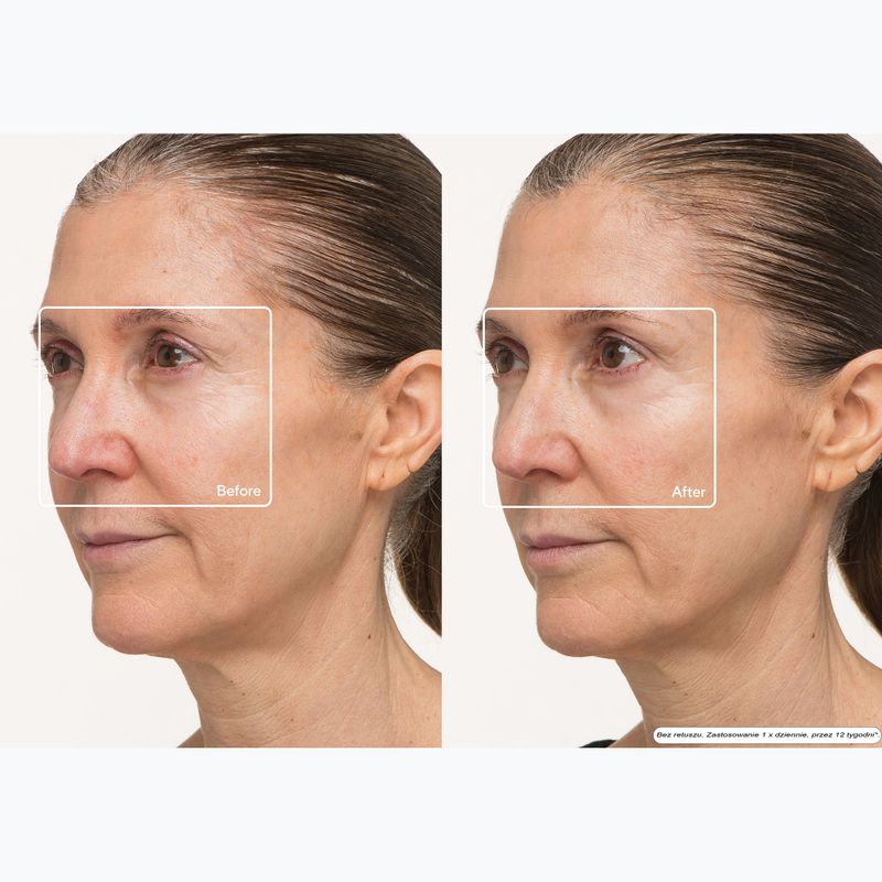 Mască de față LED Therabody TheraFace LED Mask 10