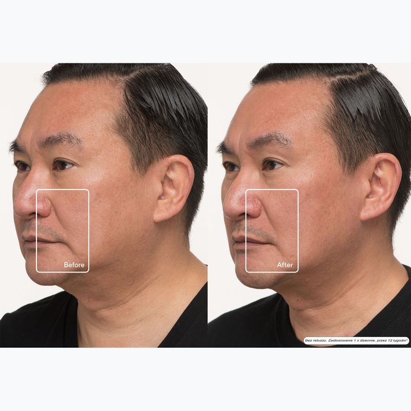 Mască de față LED Therabody TheraFace LED Mask 12