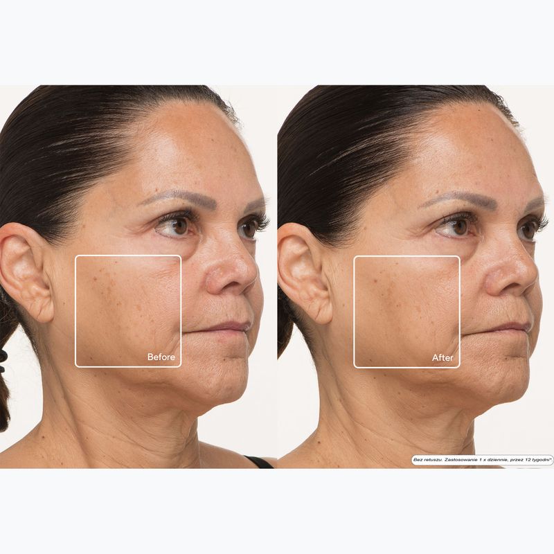 Mască de față LED Therabody TheraFace LED Mask 13